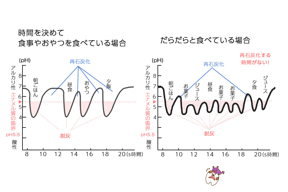 歯の脱灰　かわまがりファミリー歯科・新前橋